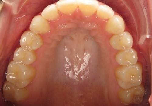 Smile assessment virtual smile assessment Charlotte nc