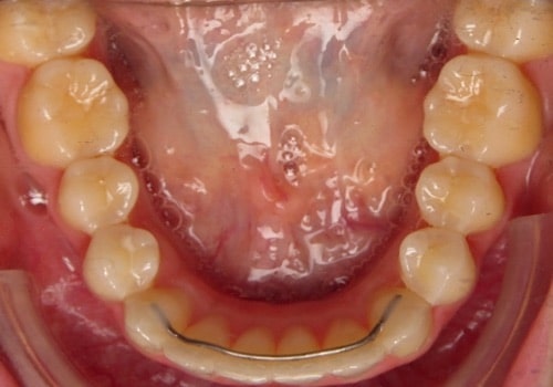 Virtual orthodontist virtual smile assessment Charlotte nc