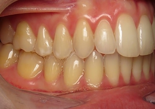 Virtual dental care virtual smile assessment Charlotte nc